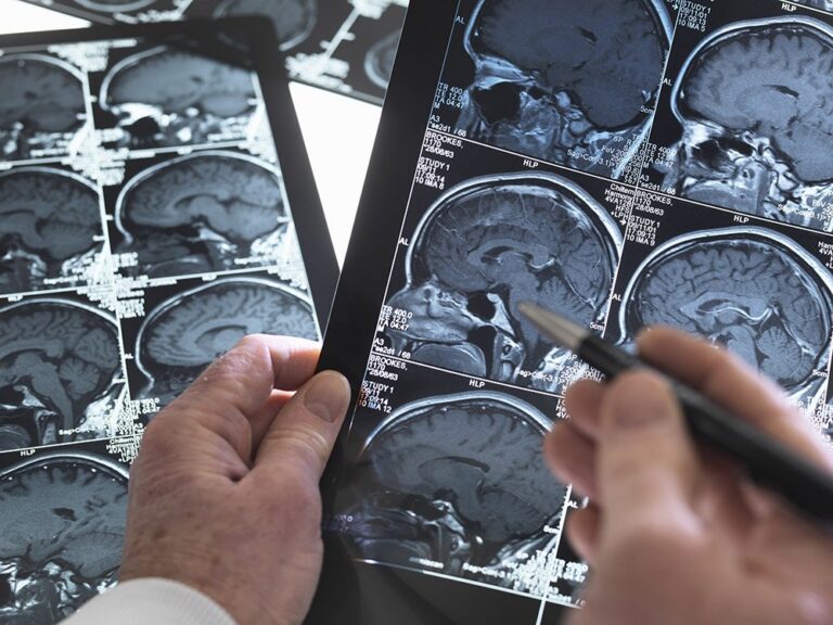 close up of doctor viewing a healthy brain scan 2024 06 07 17 40 32 utc compressed