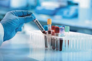 Waters免疫抑制剂校准器