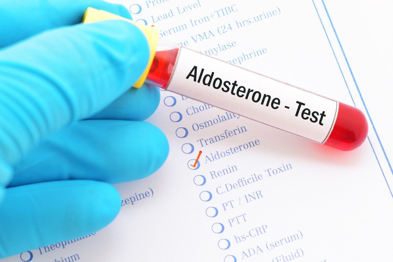 Blood sample hormone test