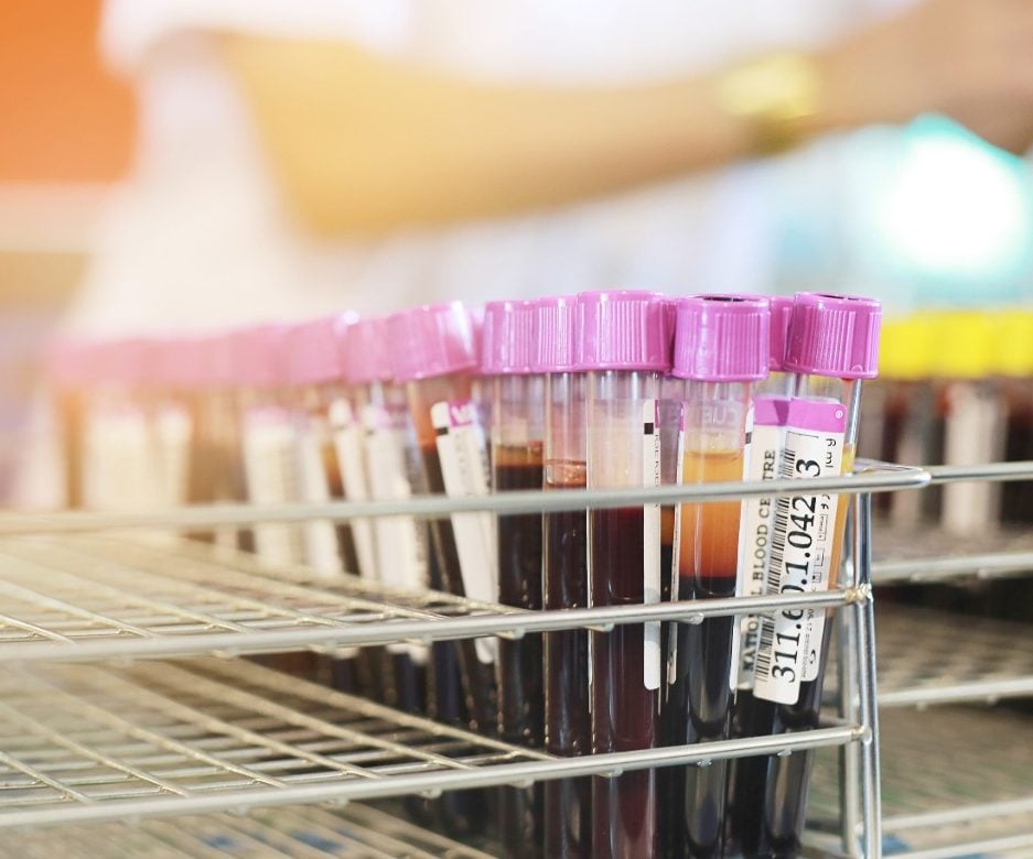 Blood sample tubes from blood donation for analysis