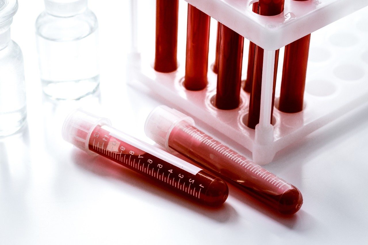 Blood samples in glass vials