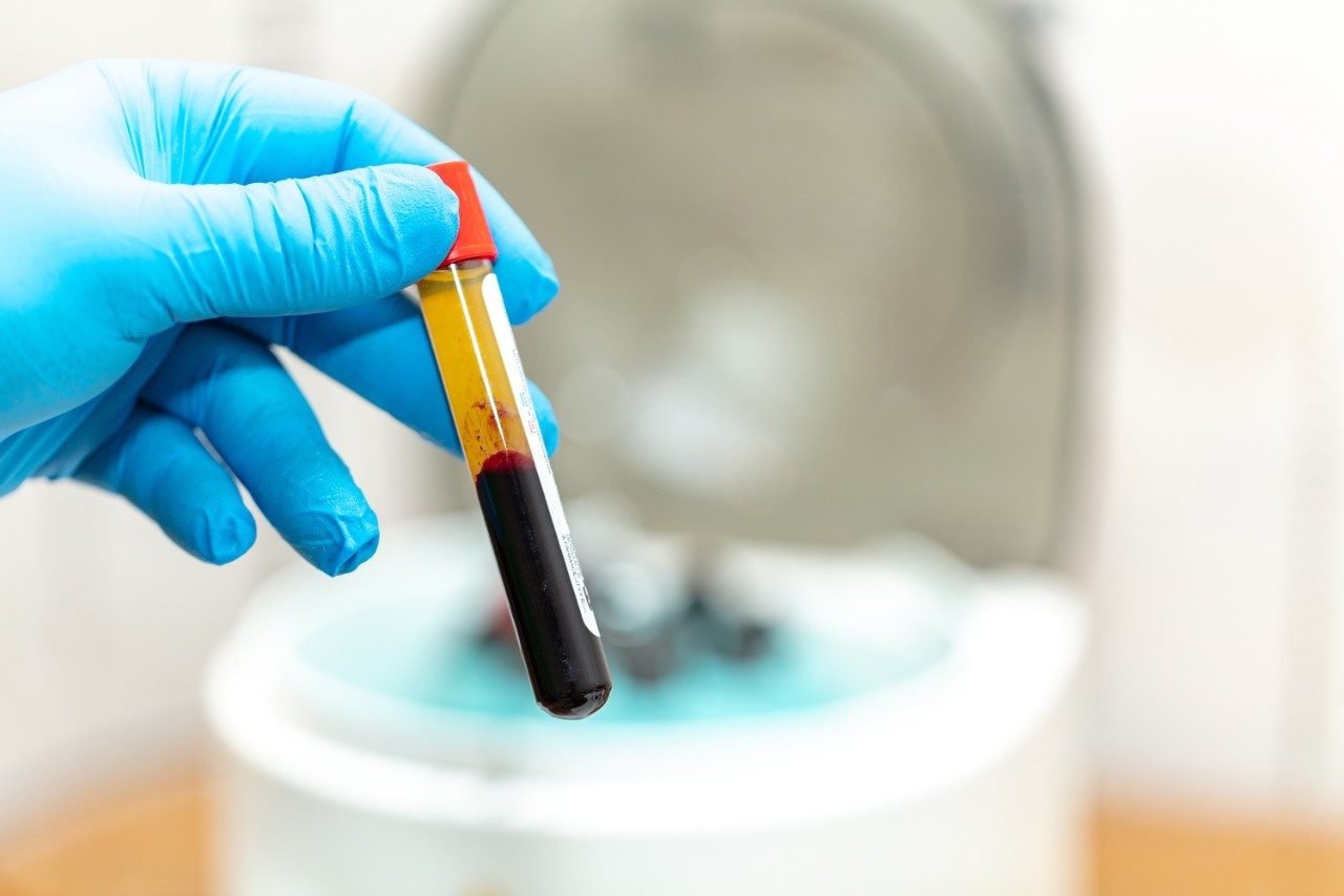 Blood plasma tube held in gloved hand