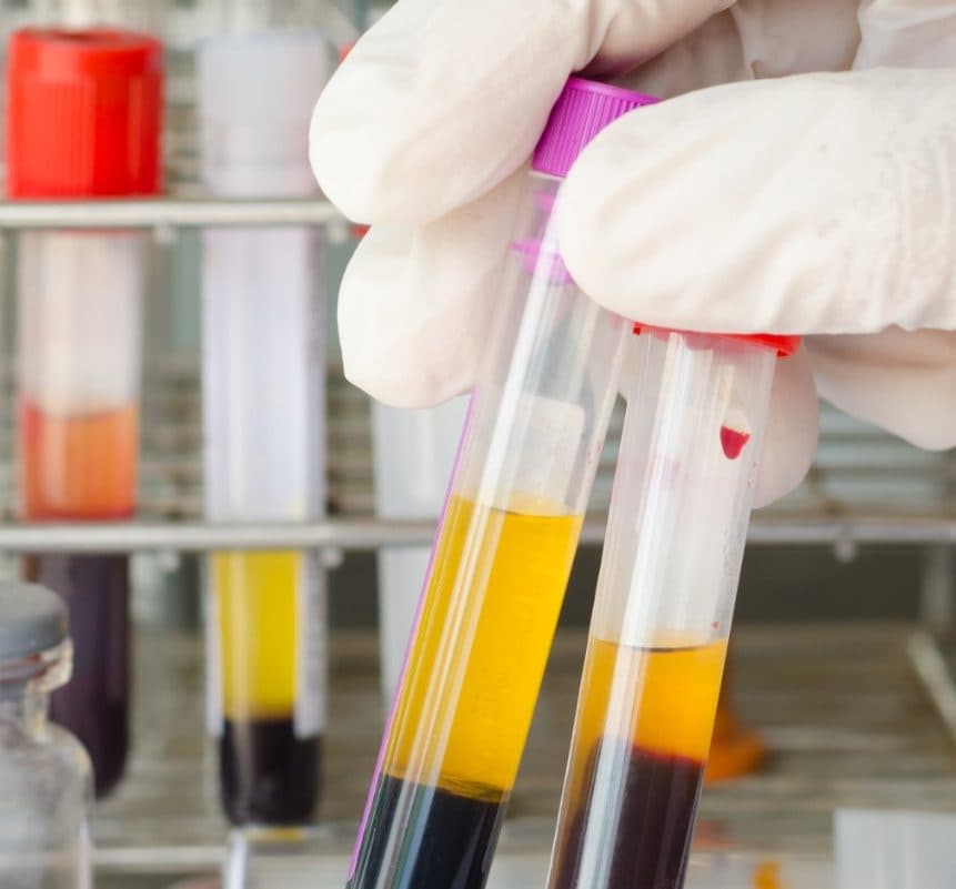 Hand holding bood plasma sample in tubes