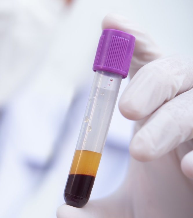 Human serum in tube in doctor's hand
