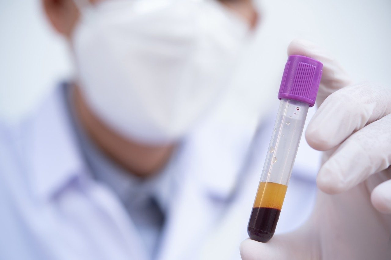 Human serum in tube in doctor's hand