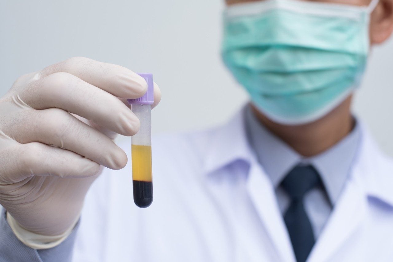 Doctor holding sample blood plasma tube