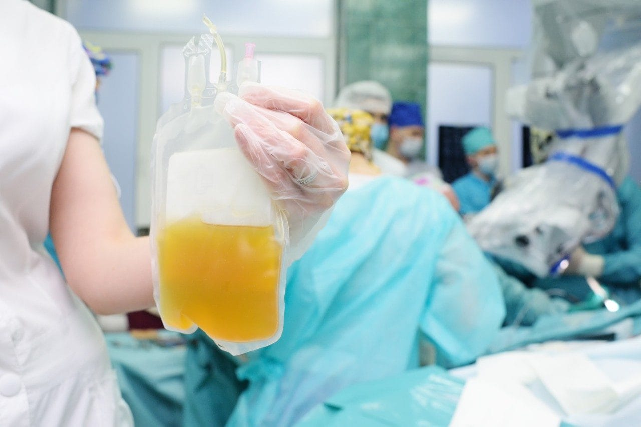 Plasma in the hands of a nurse in surgical operation room