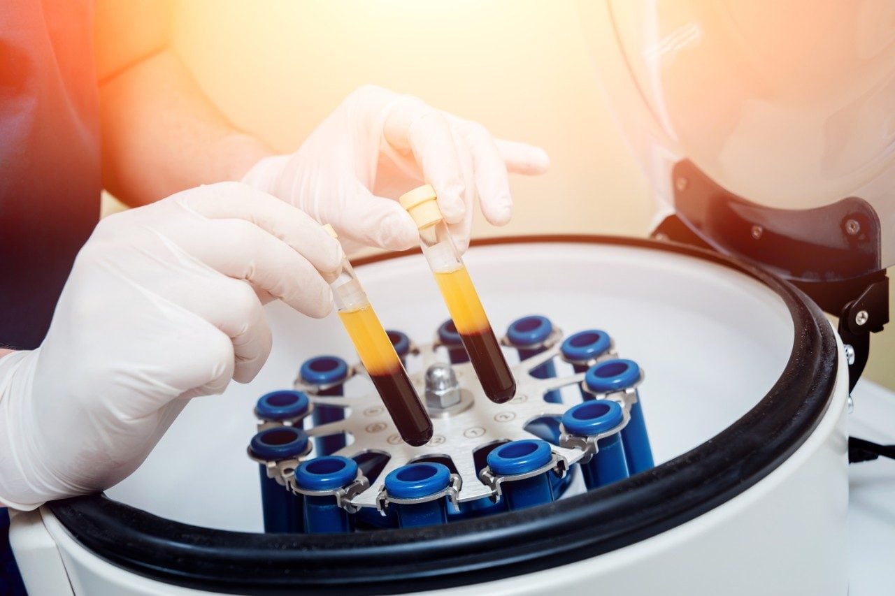 Plasma preparation for centrifuge