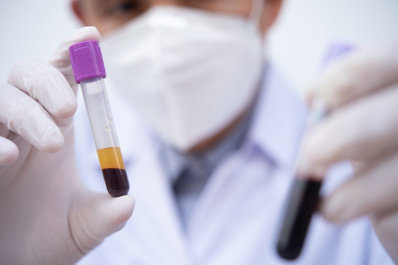 Technician holding test tube examining human centrifuged blood sample