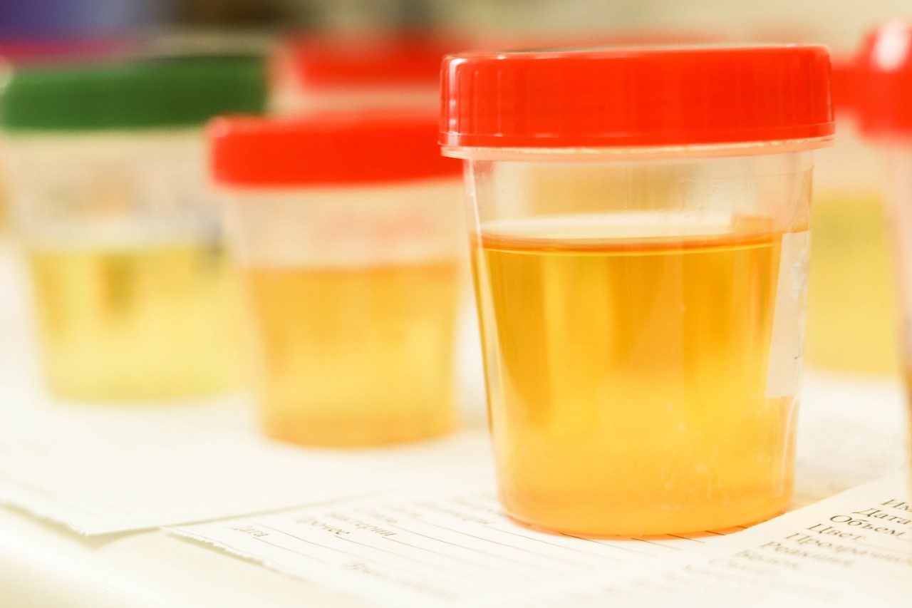 Using the Waters Forensic Toxicology Screening Application Solution
