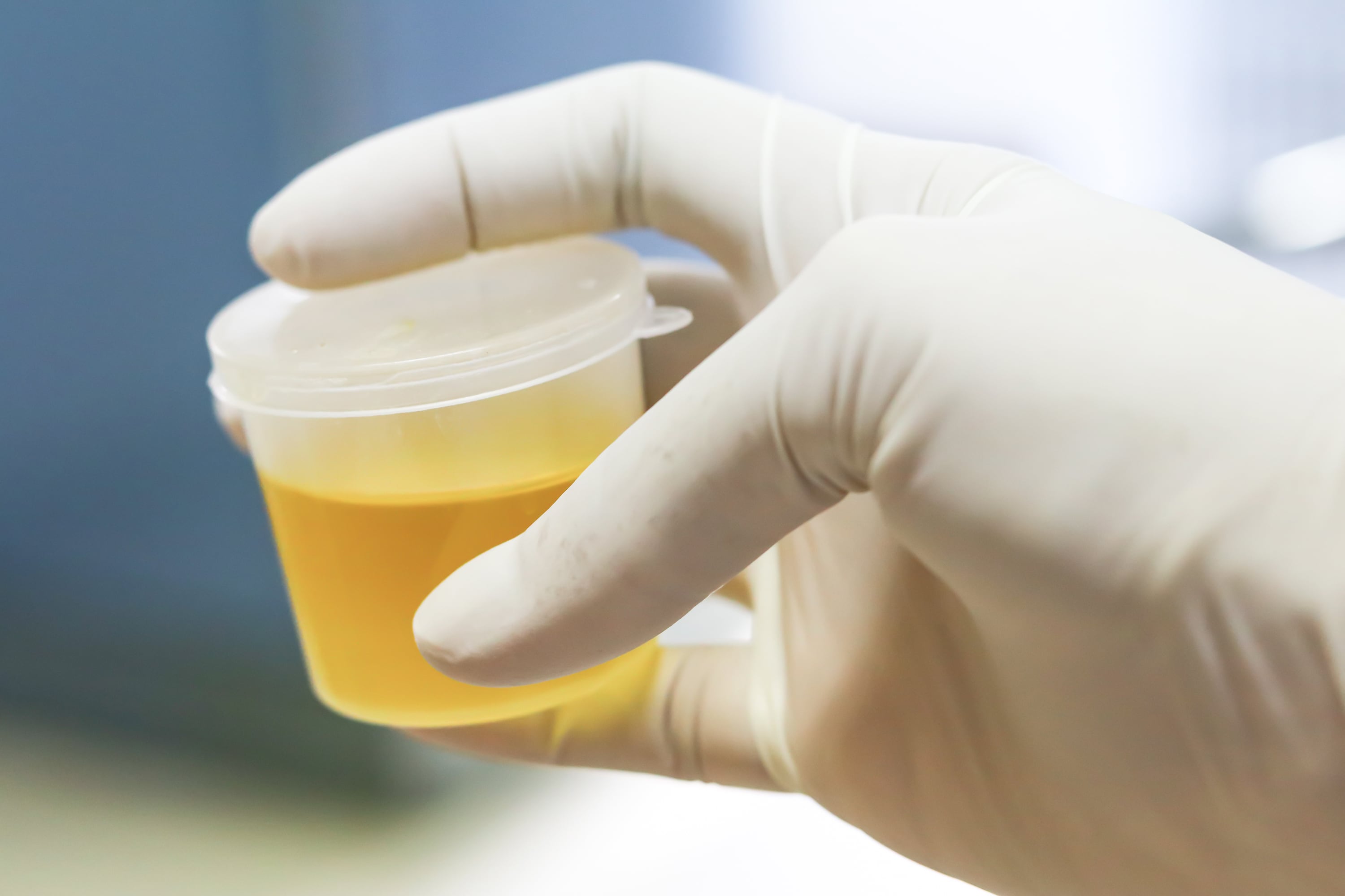 Separation And Detection Of Tca Cycle Metabolites And Related Compounds In Human Urine By Uplc Ms Ms Waters