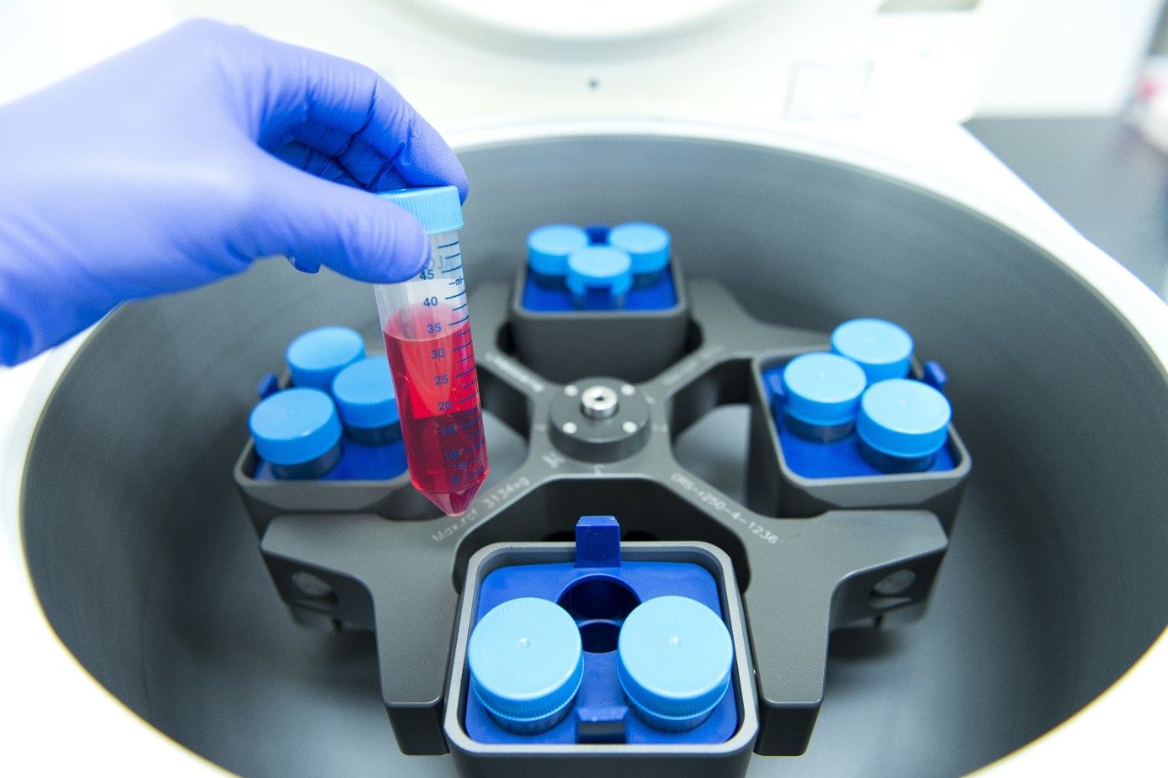 Reseacher checking cell pellets after cetrifugaton