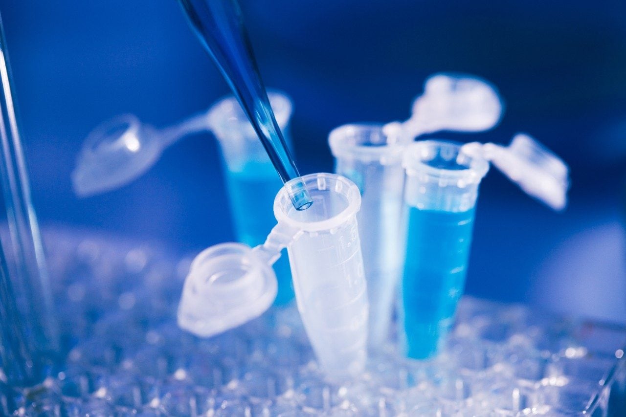Eppendorf-Probenröhrchen auf Rack mit Pipette