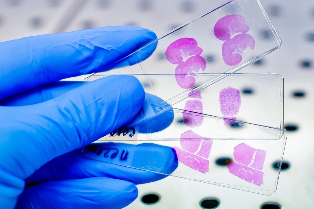 Hand in blue glove with rat tissue on slides