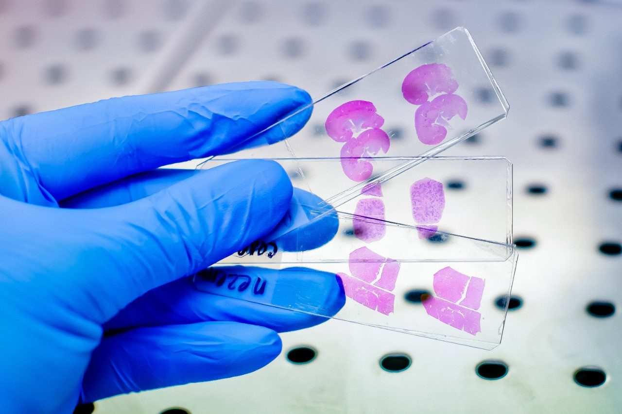 Hand in blue glove with rat tissue on slides