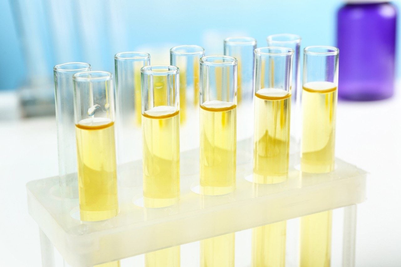 Test tubes with yellow liquid