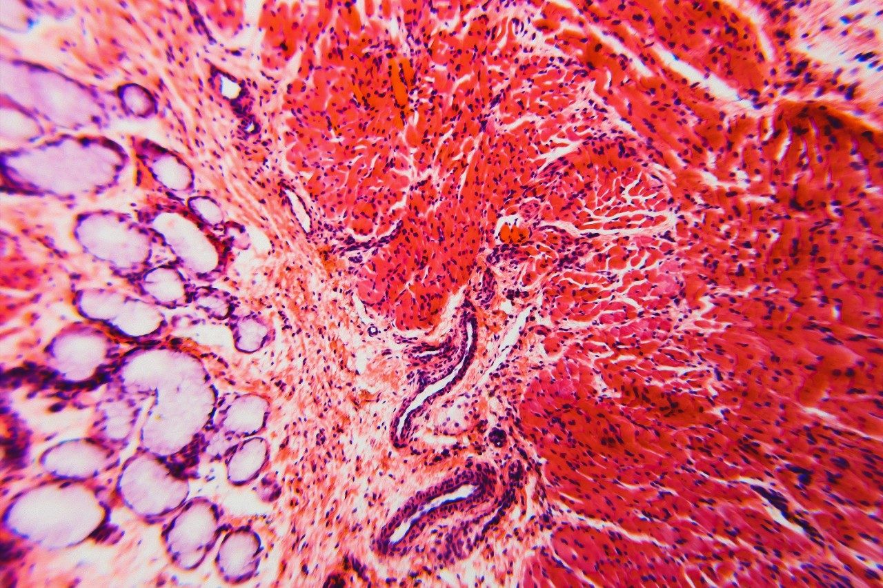 Cross section esophagus dog tissue