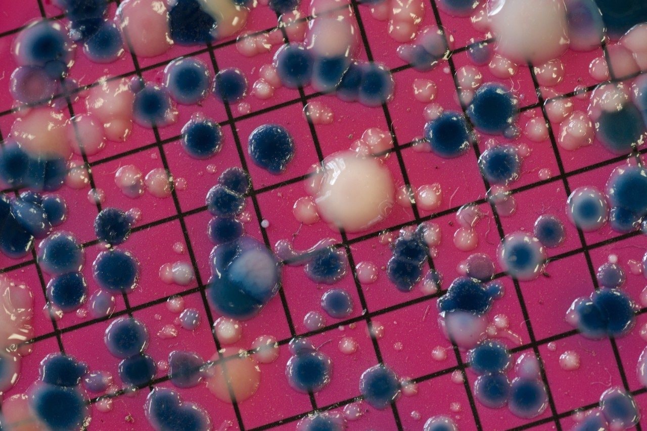 Escherichia coli colonies growing on an agar plate