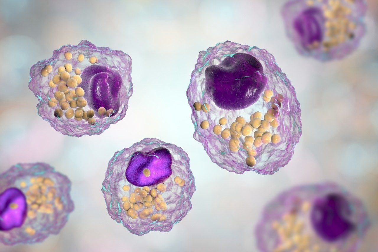 Macrophage cell with lipid droplets