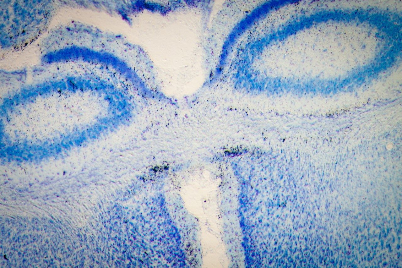 Rat brain tissue hippocampal neurons