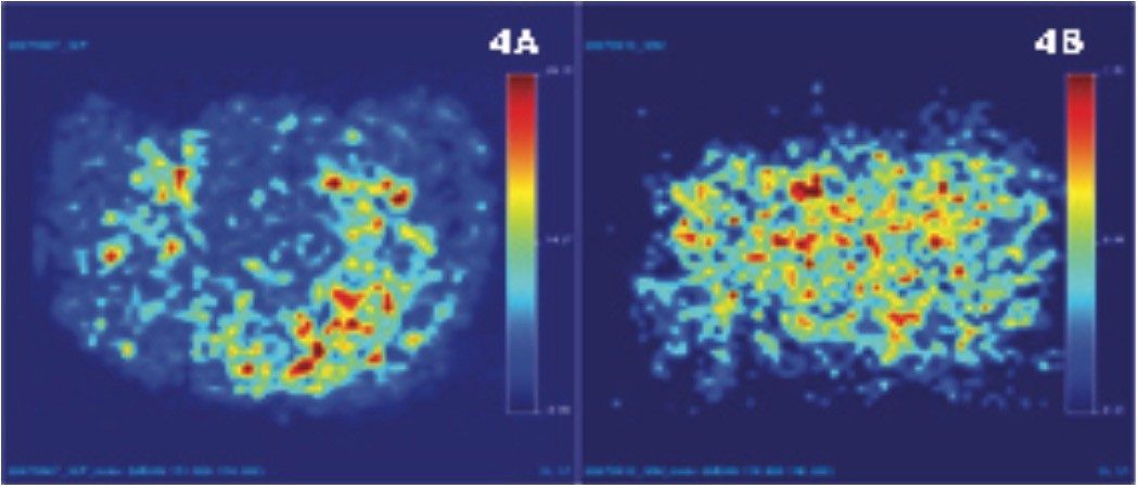 Rat brain tissue images
