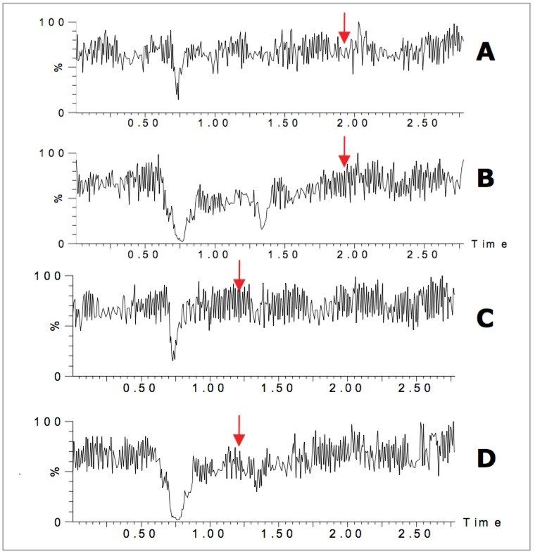 Chromatograms showing the post-column infusion of EtG (A+B) and tS (C+D).