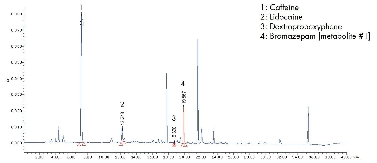 Toxicology screening chromatogram of a urine sample with HPLC/UV analysis