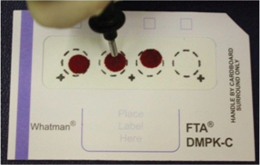 Dried blood spots on card.