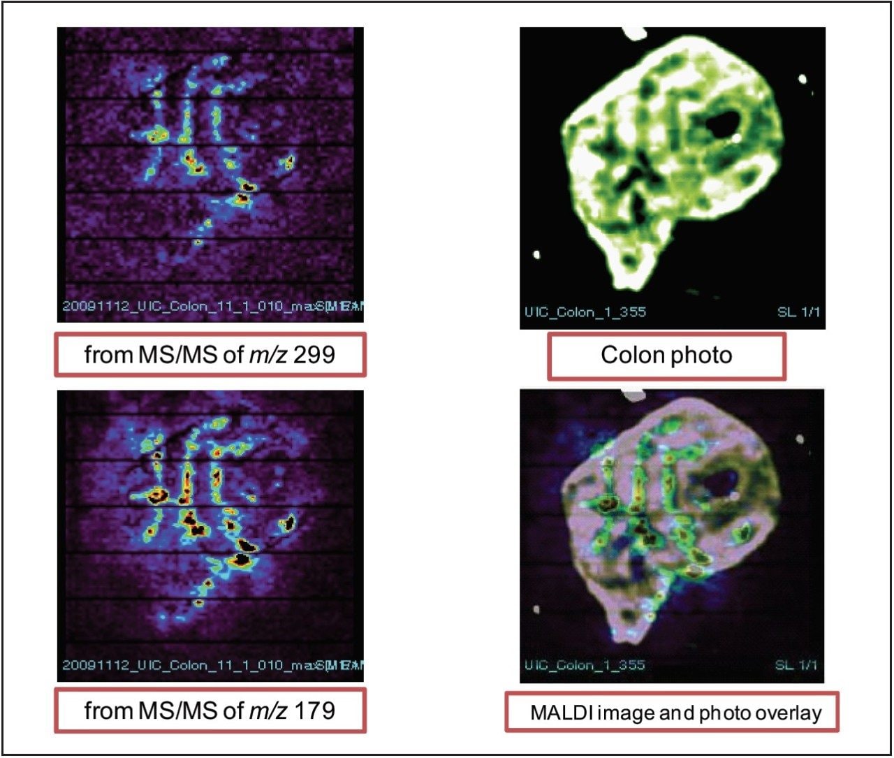 MALDI images of xanthohumol aglycone in rat colon