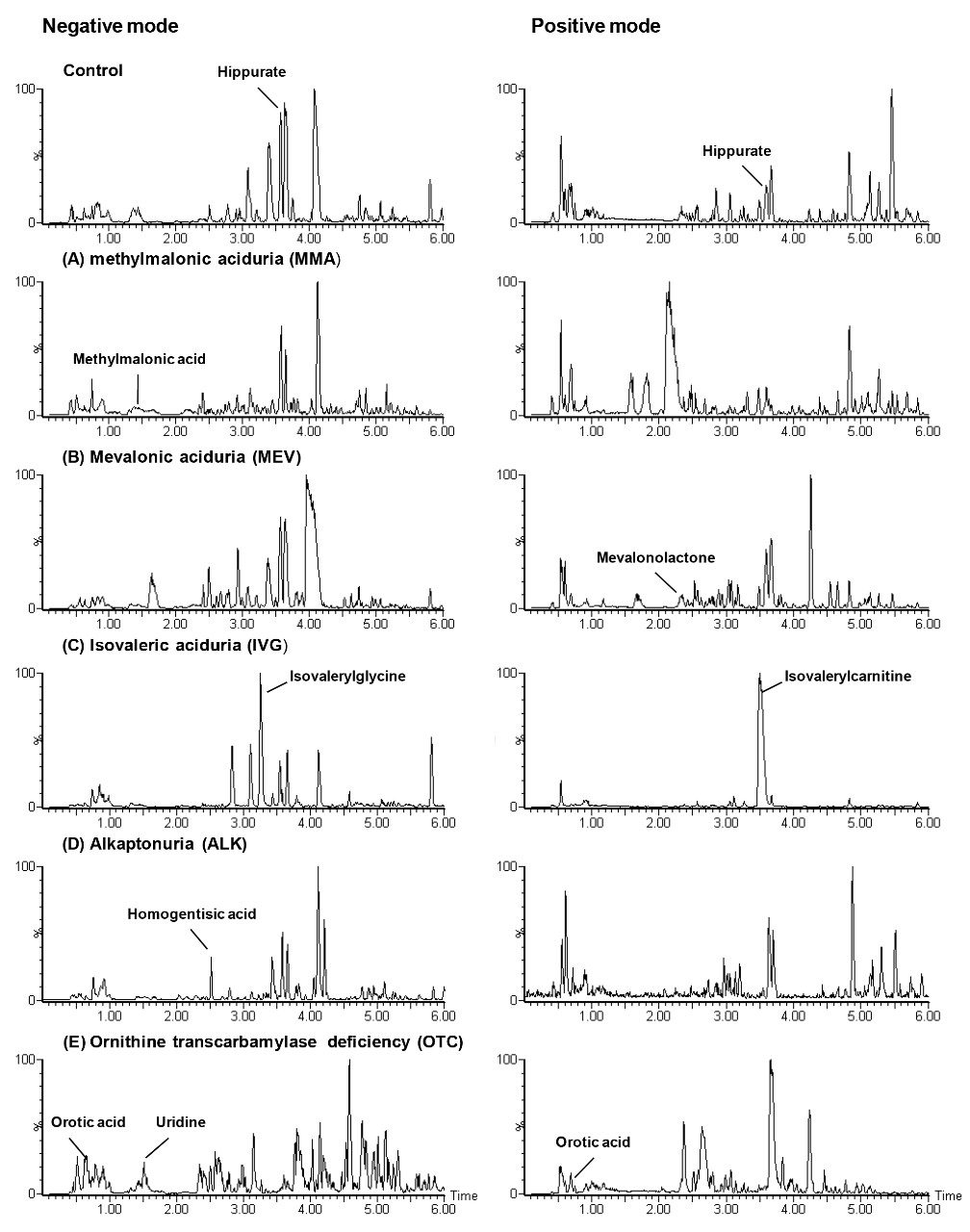 Base Peak Intensity (BPI) chromatograms between 0 – 6 mins for each IEM urine sample (A-E) and a control sample in both negative and positive ionization modes. The elevated urinary metabolite characteristic of each IEM is labelled.
