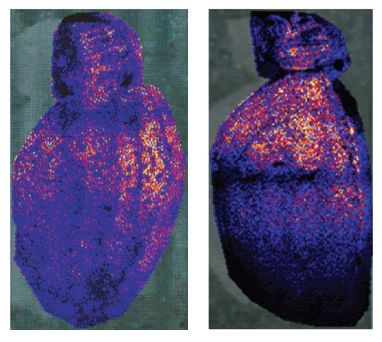 Lipid biomarker MALDI image