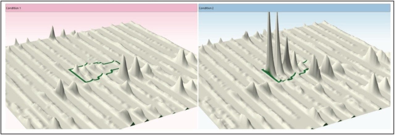 Average 3D-montage view Progenesis
