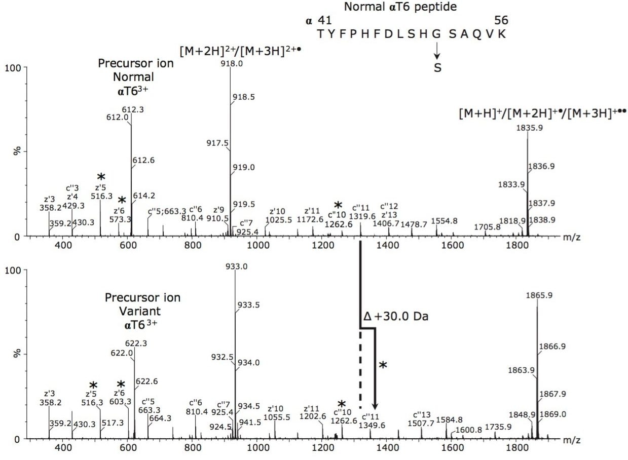 ETD product ion spectra from normal (top) and variant (bottom) αT63+ ions. The 30 Da mass-increase at z'6 and c"11 in identifies the mutation as α51Gly→Ser, Hb Riccarton.