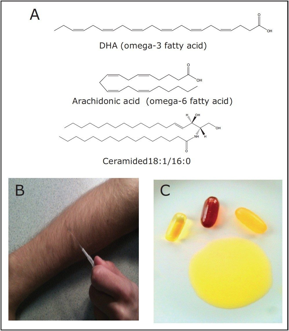 Representative lipid structures analyzed in the study