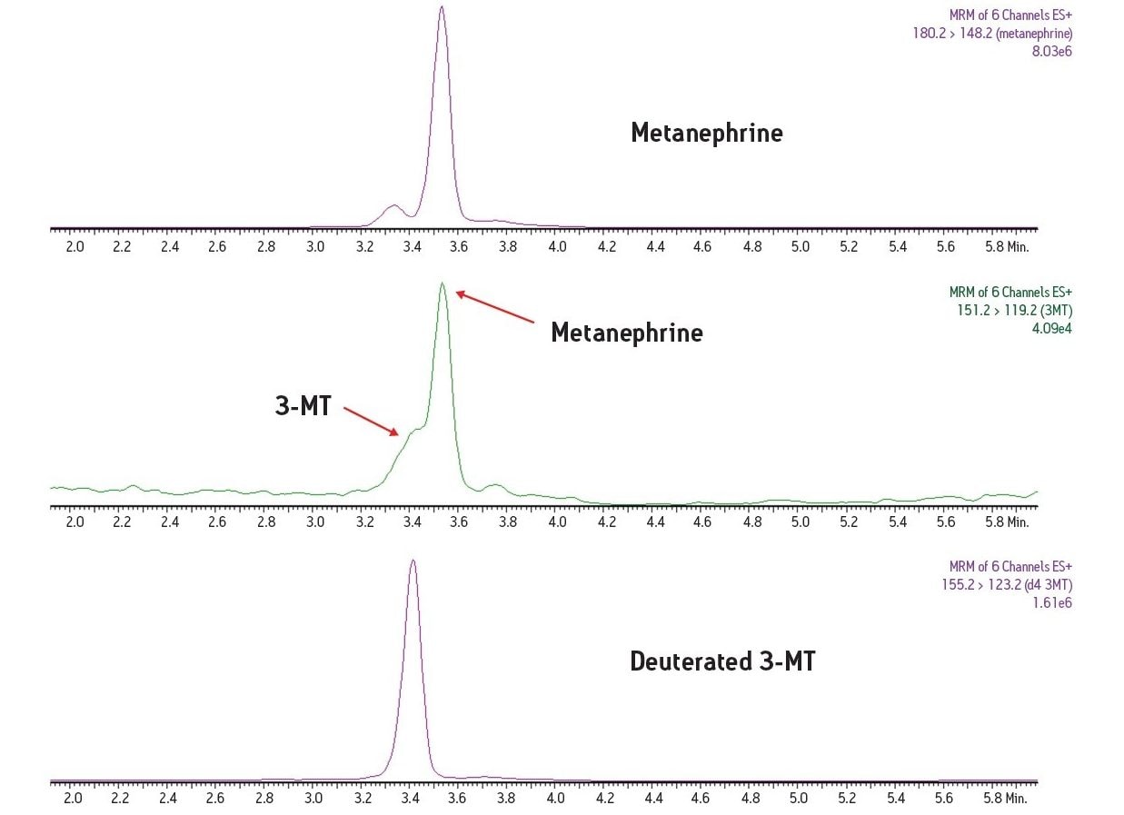 LC-MS Analysis of metanephrine and 3-methoxytyramine
