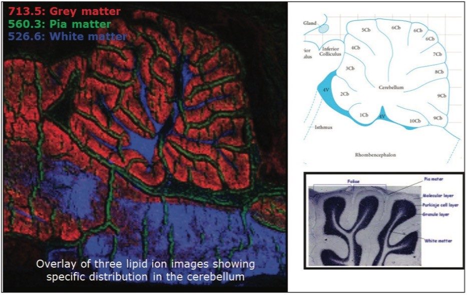  Overlay of three lipid ion images