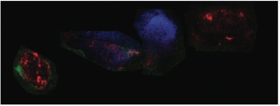 Overlay of three tryptic peptide ion images from xenograph tissue sections