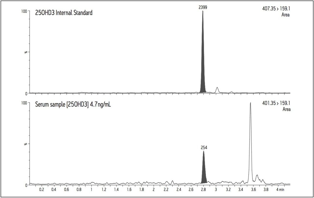 Chromatogram of a low level serum sample.