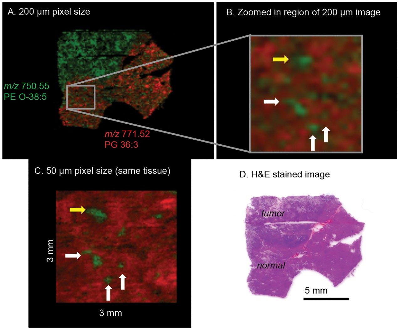 DESI imaging analyses of human liver sample in negative ion mode A
