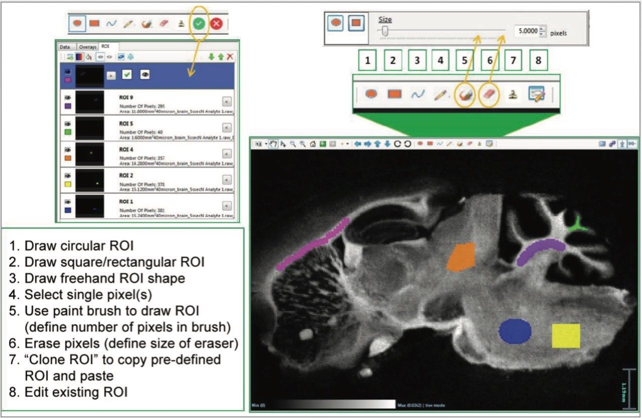 Any accepted ROI is recorded in the data management pane and depicted on the image