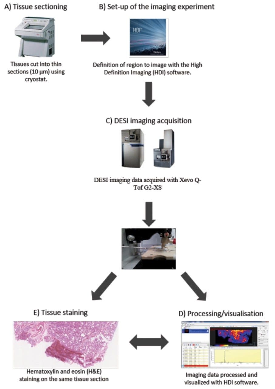 Ex vivo Lung Perfusion Tissue Analysis by Desorption Electrospray ...