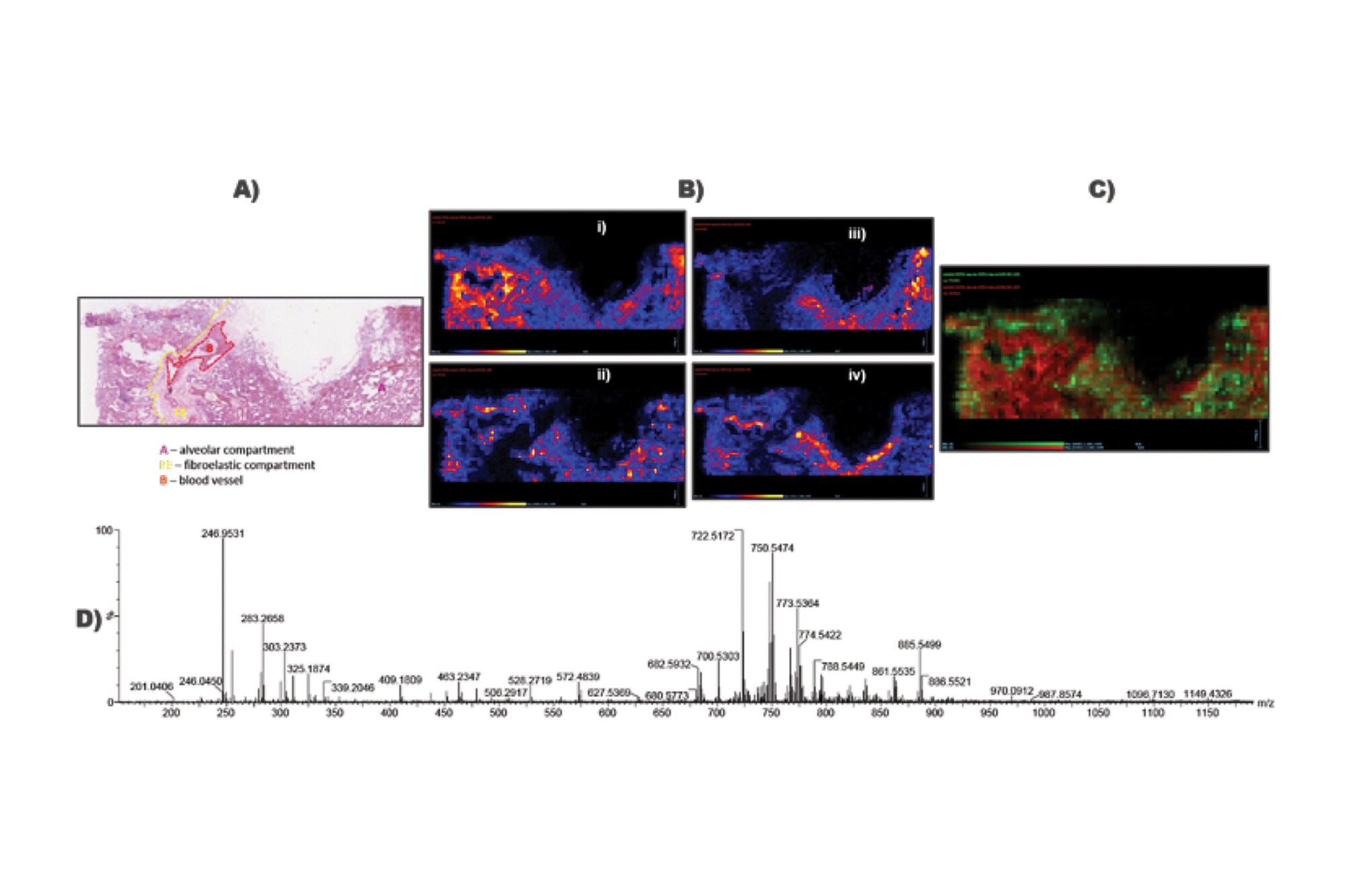 Ex vivo Lung Perfusion Tissue Analysis by Desorption Electrospray ...