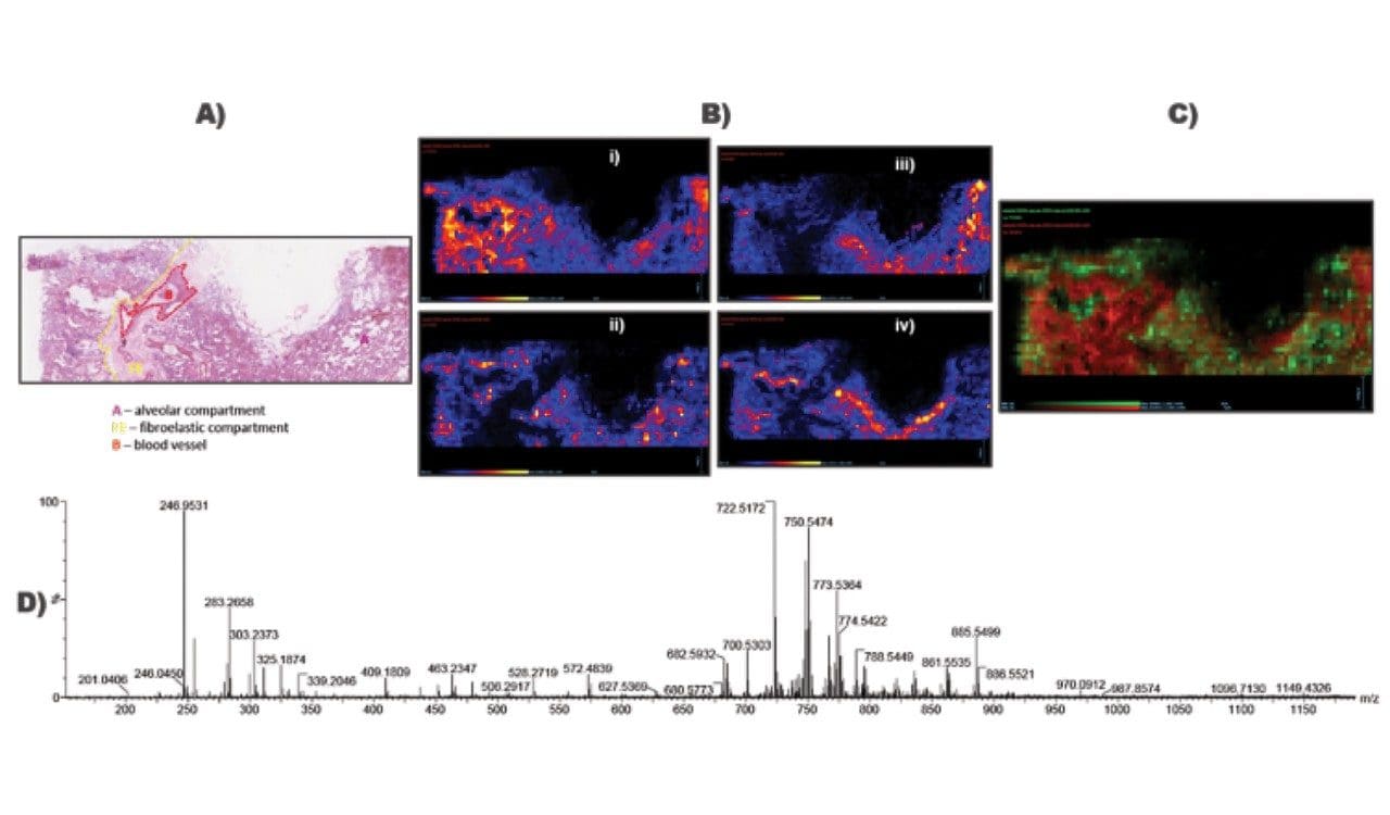DESI imaging analysis of human lung tissue section in negative ion mode. 