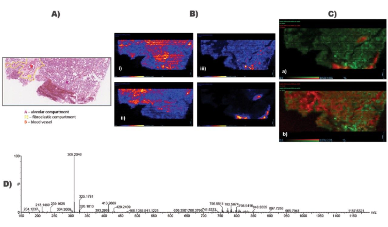 DESI imaging analysis of human lung tissue section in positive ion mode. 