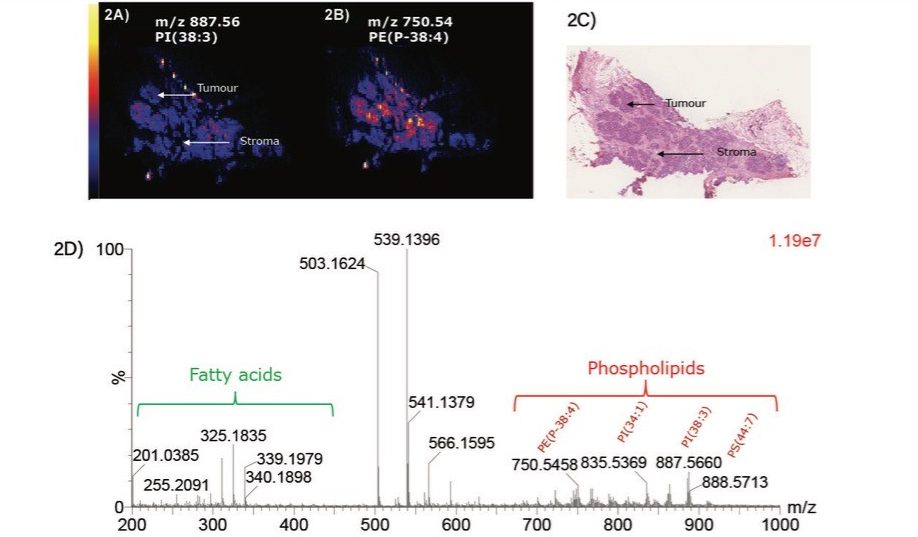 Ion images for grade 2 IDC breast sample analyzed by DESI-MSI 