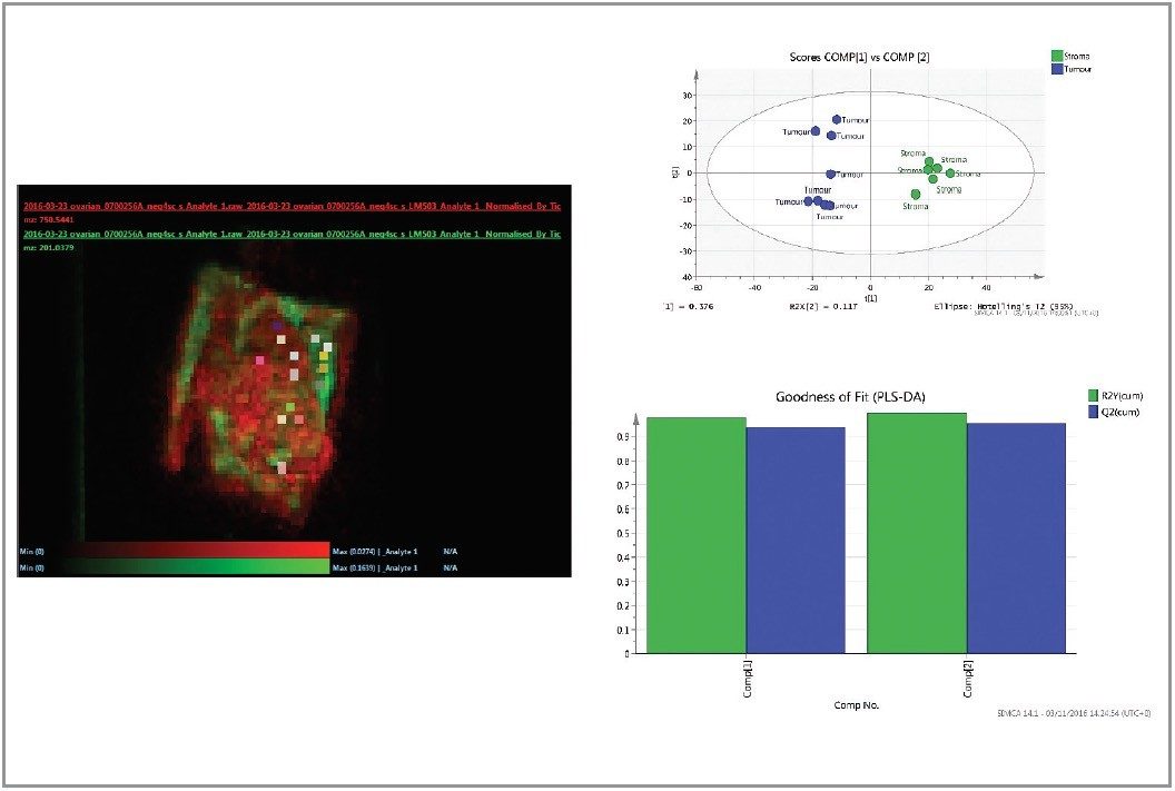 Tissue type differentiations using SIMCA statistical software tool 