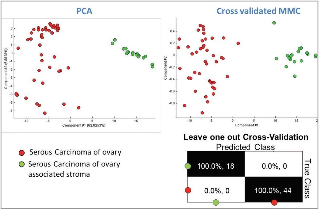 Serous carcinoma samples with two tissue types 