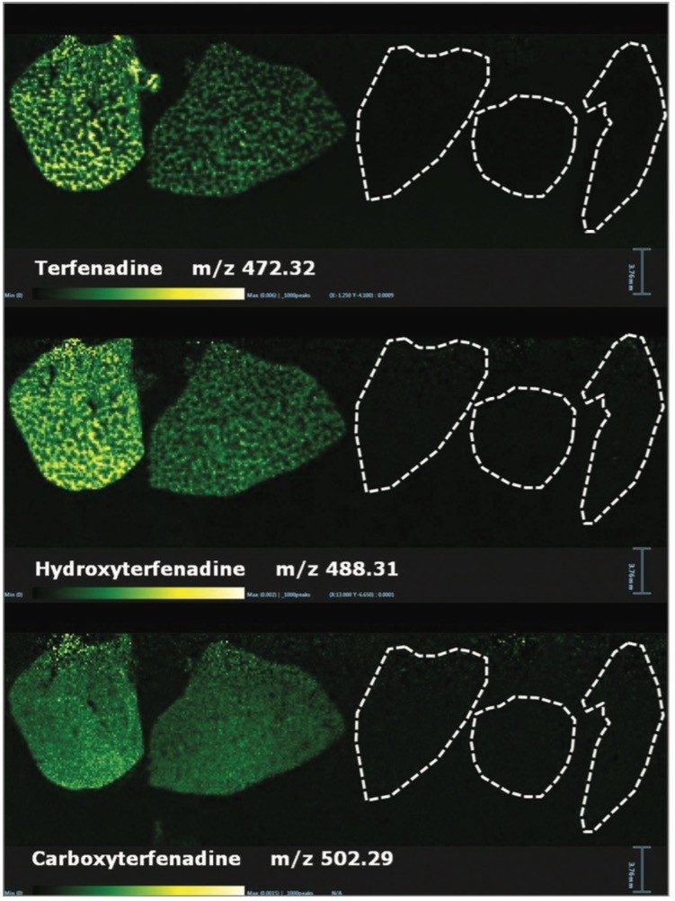 DESI-MS images of Terfenadine and two of its metabolites.