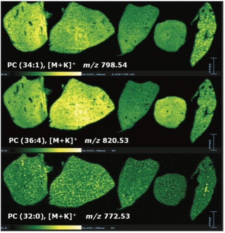 DESI-MS images of endogenous phosphatidylcholines.