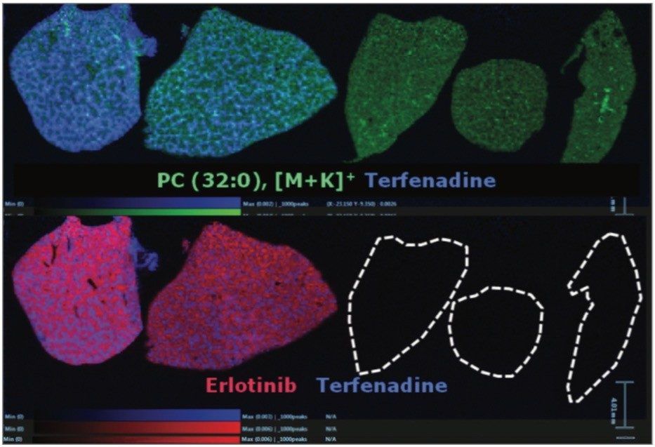 DESI-MS RGB overlay images of Erlotinib (red), endogenous phosphatidylcholine (green), and Terfenadine (blue).